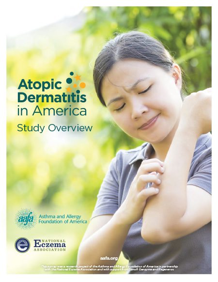 Atopic Dermatitis in America Study Overview report cover