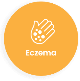 Eczema