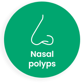 nasal polyps